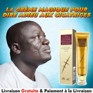 Gel Anti-Cicatrice et Vergeture LANBENA – Sentez-vous Bien dans Votre Peau
