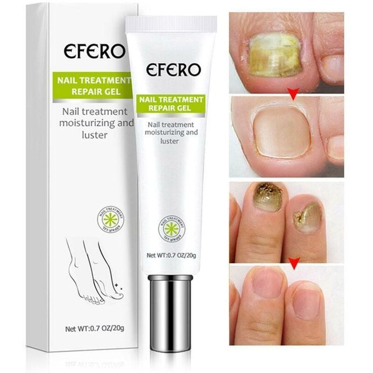 (3 boites)Crème Antibactérienne et Anti démangeaison 11500F
