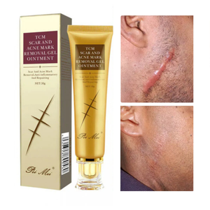 Gel Anti-Cicatrice et Vergeture LANBENA – Sentez-vous Bien dans Votre Peau